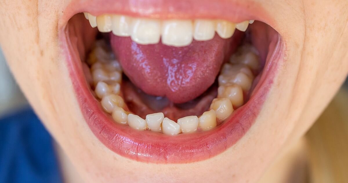 Understanding the Possible Causes of a Metallic Taste in Your Mouth and How to Address It