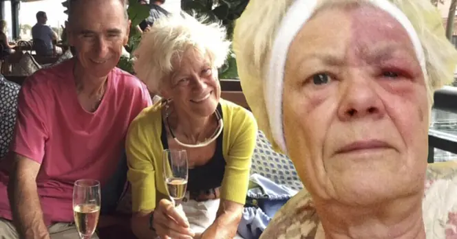 Long-Term Pain from Shingles: One Woman's 13-Year Struggle After a Simple Rash