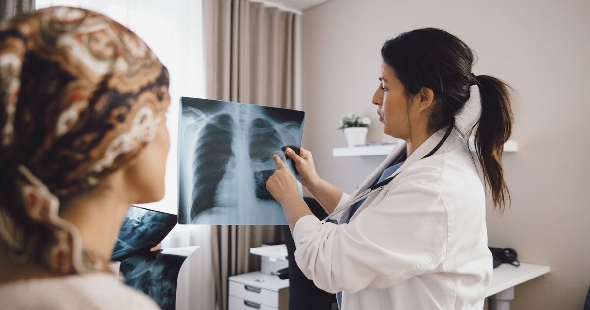 NHS Introduces Amivantamab as a New Treatment Option for Advanced Lung Cancer Patients