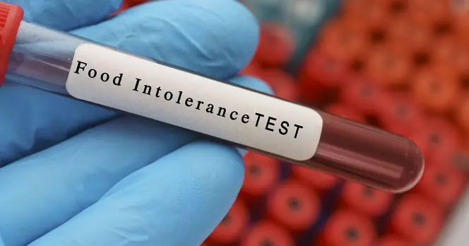 DWP Reports 500% Increase in Benefits Claims Linked to Food Issues