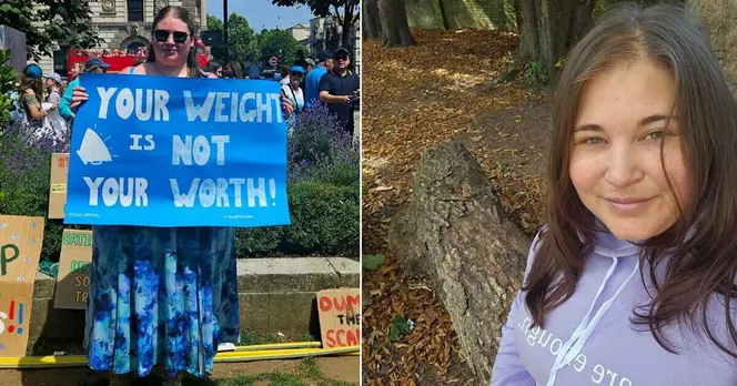 Frustration Over Lack of NHS Support for Binge-Eating Disorder: One Woman's Call for Change