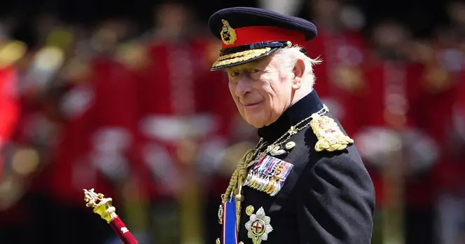 Elvis Costello Warns King Charles on Future of Royal Honours System