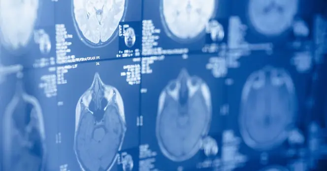 Michael Mosley Promotes Mediterranean Diet for Supporting Brain Health and Reducing Dementia Risk