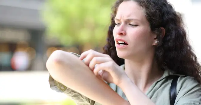 Gentle Rubbing Technique Recommended by Doctor to Alleviate Mosquito Bite Itching