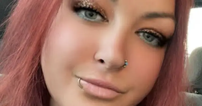 Mum Suffers Severe Facial Injuries in Car Engine Accident
