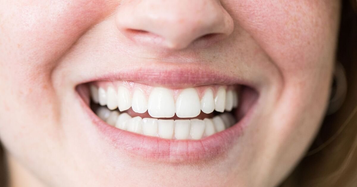 Strawberries Can Help Whiten Teeth Naturally and Improve Oral Health